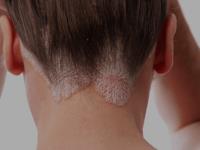 Array Skin Therapy image 4