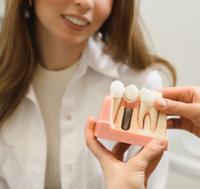 Dr Rana Baroudi - Dental Implants image 2