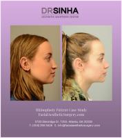Atlanta Facial Plastic Surgery image 4