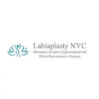 Labiaplasty NYC image 4