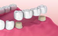 Hillsborough Prime Dental image 2