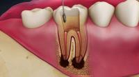 Hillsborough Prime Dental image 1