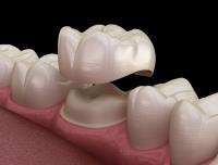 Hillsborough Prime Dental image 6