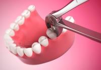 Hillsborough Prime Dental image 3