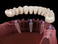 Hillsborough Prime Dental image 4