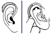 No Hearing Loss image 2