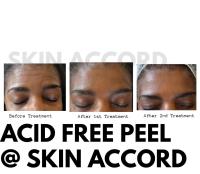 Skin Accord image 3