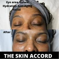 Skin Accord image 4