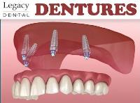 Legacy Dental image 6
