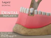 Legacy Dental image 8