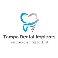 Tampa Dental Implants image 1