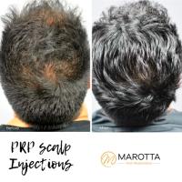 Marotta Hair Restoration image 3