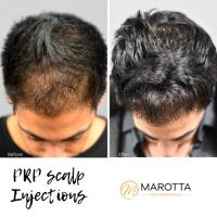 Marotta Hair Restoration image 4