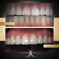 Lasting Impressions Dental Spa image 4