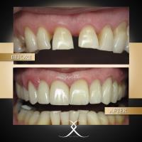 Lasting Impressions Dental Spa image 5