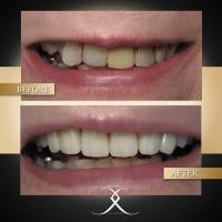 Lasting Impressions Dental Spa image 6