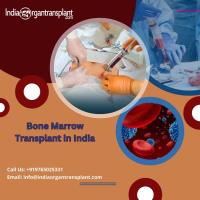 Bone Marrow Transplant In India image 1