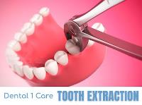 Dental 1 Care image 3