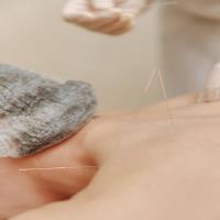 Juheng Acupuncture Clinic image 1