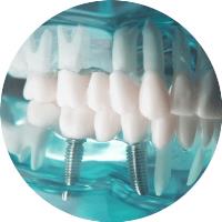 Smile Now Dental Implant Center image 2