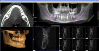 Pacific Dental & Implant Solutions image 7
