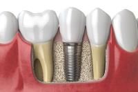Eggleston Dental Care image 6