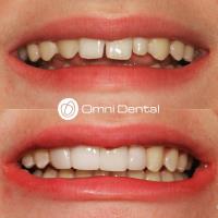 Omni Dental Chelmsford image 3