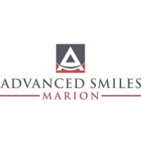 Advanced Smiles Marion image 1