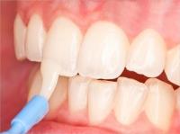 Premier Valley Dental image 4