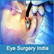 Eye Surgery Cost In India image 1