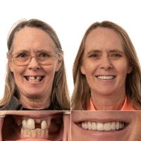 JAX Dental Implants & Dentures image 4