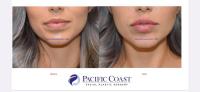 Pacific Coast Facial Plastic Surgery image 2