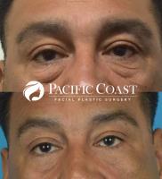 Pacific Coast Facial Plastic Surgery image 3