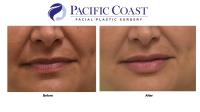 Pacific Coast Facial Plastic Surgery image 4