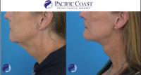 Pacific Coast Facial Plastic Surgery image 5