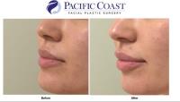 Pacific Coast Facial Plastic Surgery image 6