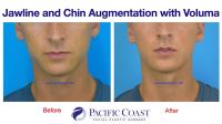 Pacific Coast Facial Plastic Surgery image 7