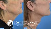 Pacific Coast Facial Plastic Surgery image 10