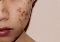 Dana Point Acne Lab & Skincare Studio image 11