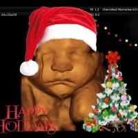 Cherished Memories 3D/4D Ultrasound image 4