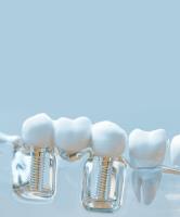 Implant & Cosmetic Dentistry of Northern Indiana image 5