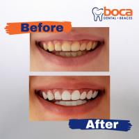 Boca Dental and Braces image 5