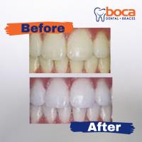 Boca Dental and Braces image 4