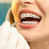 Boca Dental and Braces image 8