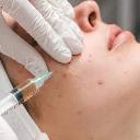 Acne Treatment in dubai logo