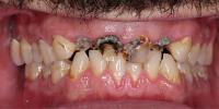 Kosh Dental image 3