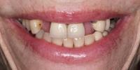 Kosh Dental image 4