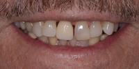 Kosh Dental image 7
