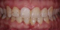 Kosh Dental image 13
