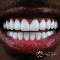 Dental Design Smile Miami image 2
